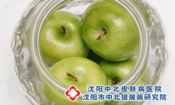 对牛皮癣的患者有益的水果