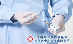 牛皮血癣生物制剂的副作用