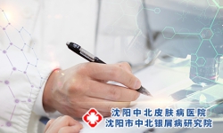 沈阳排名好的牛皮癣医院：牛皮癣的病因是什么呢