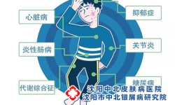 银屑病长期不愈对身体有什么影响?