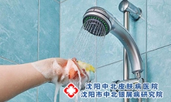 银屑病患者怎么正确洗澡?