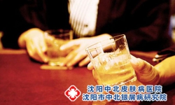 沈阳中北银屑病医院：喝酒对银屑病有什么影响?