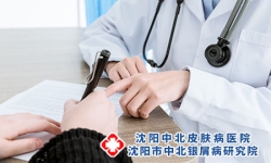 银屑病瘙痒，教你正确去除瘙痒