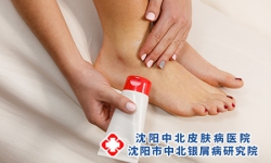 牛皮癣患者怎样护理好你的皮肤？