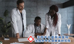 患上牛皮癣病理是什么？