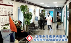 沈阳哪家牛皮癣病医院比较好牛皮癣治疗费用大概是多少