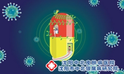 牛皮癣不扩散可以不治疗吗？