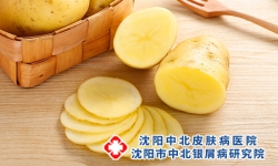 土豆治疗牛皮癣真的有效吗？