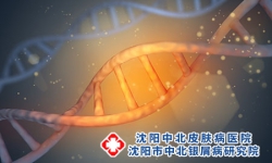 牛皮癣具体的发病原因有哪些