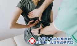 斑块状银屑病的危害有哪些?