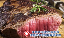 银屑病吃高蛋白好吗？
