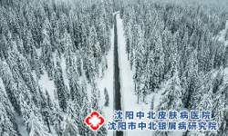 冬季牛皮癣病情会加重吗?