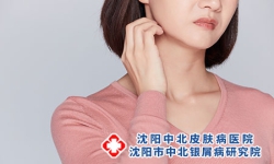 皮肤微生态与银屑病的关系