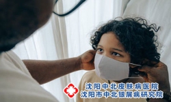 盘点牛皮癣发病的外因