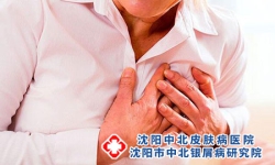 得银屑病是因为内脏有问题吗