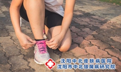 为什么出汗会加重银屑病?专家带你了解真相!