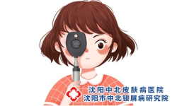 如何选择牛皮癣的治疗方法？