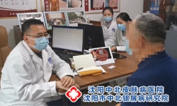 沈阳治疗银屑病：皮肤镜检查可以查出银屑病吗?