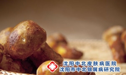 牛皮癣病人能不能吃蘑菇类食物?