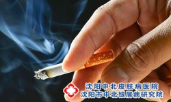 怎样有效地预防牛皮癣的恶化?