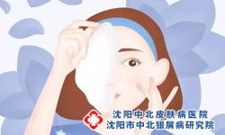 沈阳治疗牛皮癣的医院：牛皮癣患者需要避免哪些生活习惯?