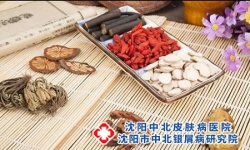 了解一下牛皮癣能根治吗 中药治疗提高治愈机率