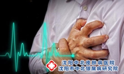 重度牛皮癣有可能导致心脏病