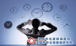 怎样治银屑病 银屑病有哪些需要注意的事项