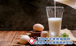 牛皮癣患者常喝牛奶好处多
