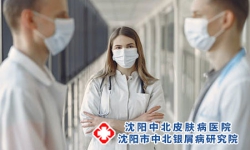 牛皮癣和艾滋病会有关系吗？