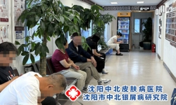 反向型银屑病多久能好 褶皱部位皮损恢复周期指南