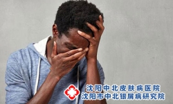 牛皮癣大概多久会加重?