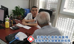 沈阳中北牛皮癣医院排名-沈阳治疗牛皮癣医院