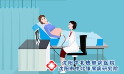 牛皮癣患者可以怀孕吗 牛皮癣有什么要注意的