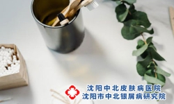 牛皮癣的外治偏方有哪些？