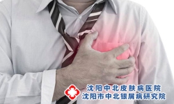 牛皮癣患者可能会并发心脏病？