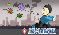 牛皮癣患者应避免的问题