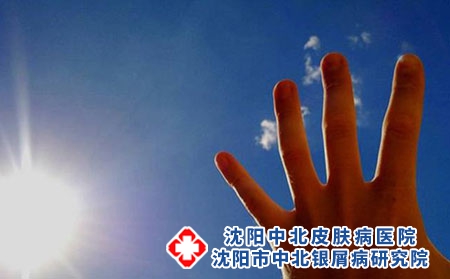 牛皮癣饮食应该注意哪些_沈阳苏家屯银屑病医院哪家好