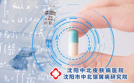 成人牛皮癣患者平时该注意什么?沈阳哪家治疗银屑病专科医院?