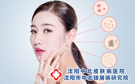 摄图网_500764539_女性皮肤病（企业商用）