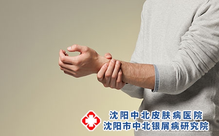 摄图网_501528683_青年男性手腕疼痛（企业商用）