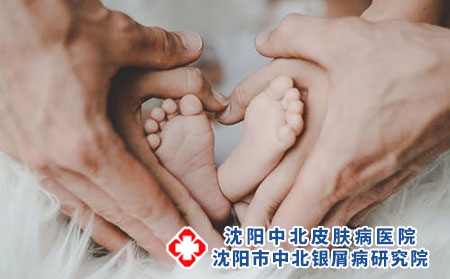 4 (424)儿童家庭遗传