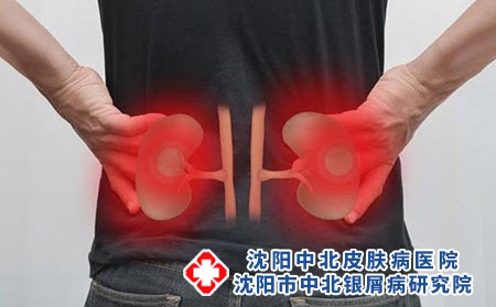 2 (162)肾 共病