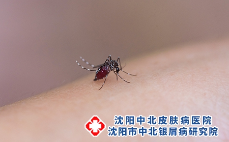 摄图网_501387268_正在吸血的蚊子（企业商用）