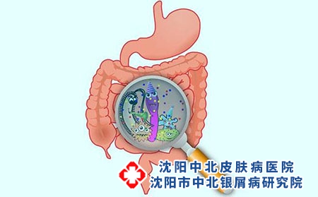 2 (192)肠胃 共病