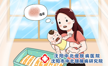 摄图网_401767228_婴儿湿疹（企业商用）