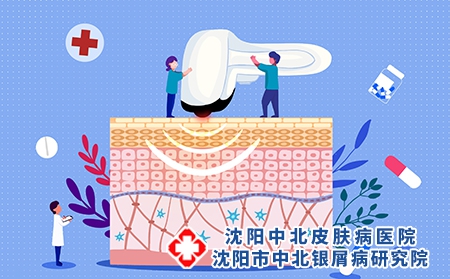 摄图网_401916207_光子嫩肤医美配图（企业商用）