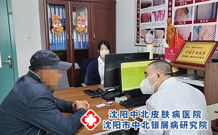 沈阳看银屑病专科-沈阳市中北银屑病研究院-沈阳哪能治疗银屑病