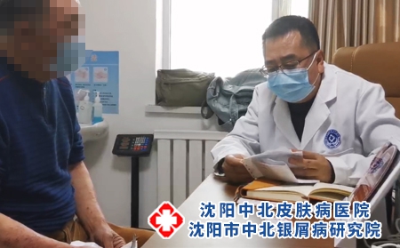 沈阳看银屑病去哪-沈阳市中北银屑病研究院-沈阳哪些治疗银屑病
