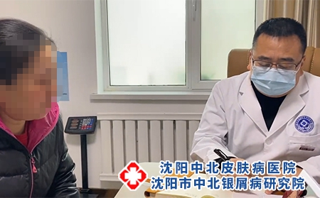 沈阳看银屑病哪好-沈阳市中北银屑病研究院-沈阳哪有治疗银屑病